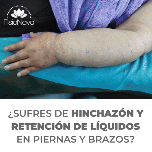 Drenaje línfatico